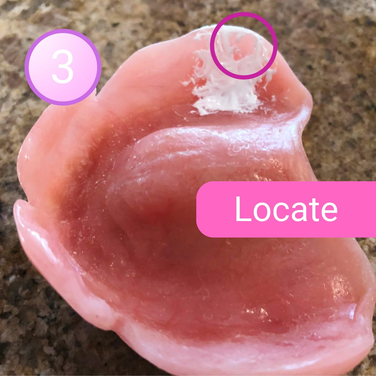 Denture Sore Spot Kit Z7256